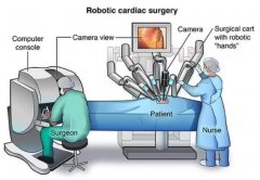 <strong>英国首例机器人心瓣手术 最后成功了吗</strong>